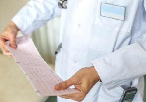 doctor interprets the results of his patient. Doctor is holding and looking at electrocardiogram paper.